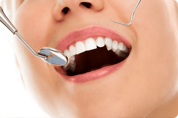 Отбелить зубы в домашних условиях без вреда